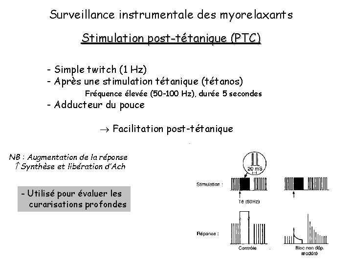 Surveillance instrumentale des myorelaxants Stimulation post-tétanique (PTC) - Simple twitch (1 Hz) - Après