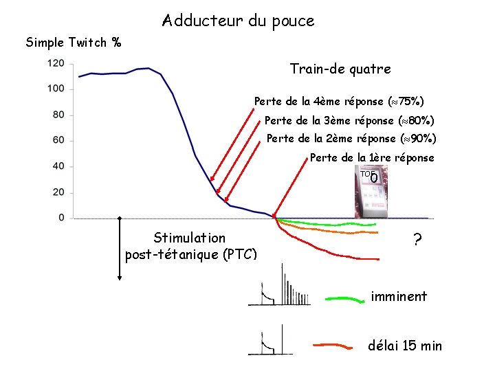 Adducteur du pouce Simple Twitch % Train-de quatre Perte de la 4ème réponse (