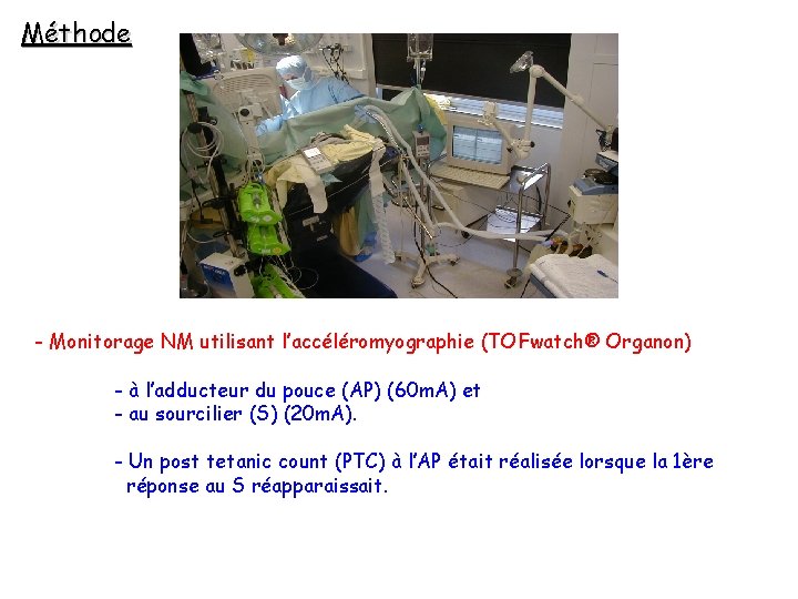 Méthode - Monitorage NM utilisant l’accéléromyographie (TOFwatch® Organon) - à l’adducteur du pouce (AP)