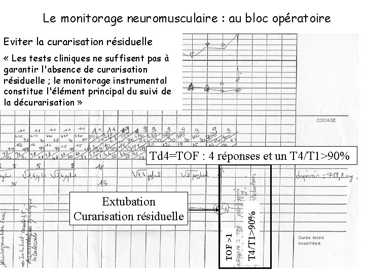 Le monitorage neuromusculaire : au bloc opératoire Eviter la curarisation résiduelle « Les tests