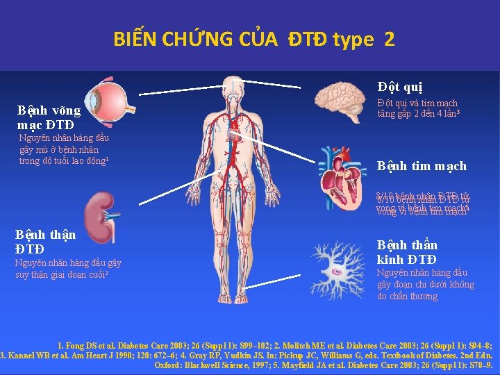 BIẾN CHỨNG CỦA ĐTĐ type 2 Đột quị Bệnh võng mạc ĐTĐ Nguyên nhân BIẾN CHỨNG CỦA ĐTĐ type 2 Đột quị Bệnh võng mạc ĐTĐ Nguyên nhân