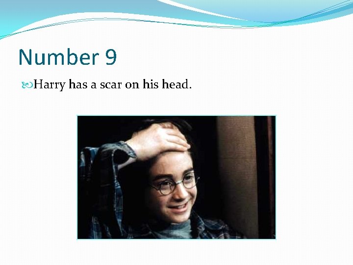 Number 9 Harry has a scar on his head. 