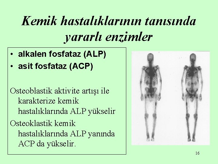 Kemik hastalıklarının tanısında yararlı enzimler • alkalen fosfataz (ALP) • asit fosfataz (ACP) Osteoblastik