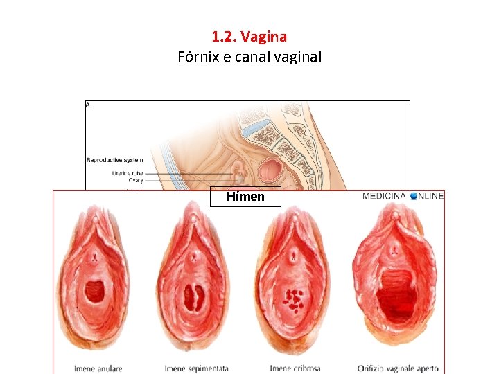 1. 2. Vagina Fórnix e canal vaginal Hímen 