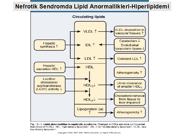 Nefrotik Sendromda Lipid Anormallikleri-Hiperlipidemi 