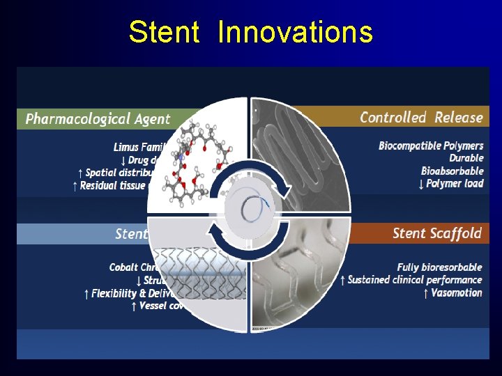 Stent Innovations Stent Innovations