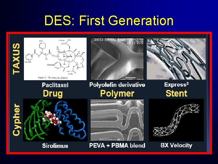 DES: First Generation DES: First Generation