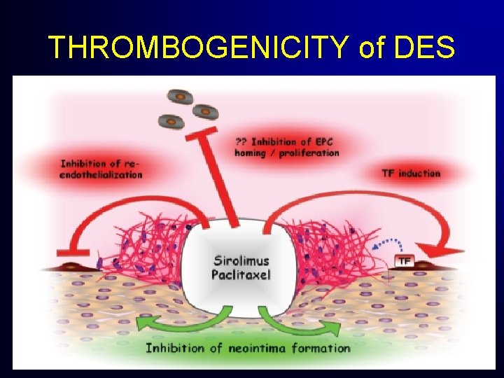 THROMBOGENICITY of DES THROMBOGENICITY of DES