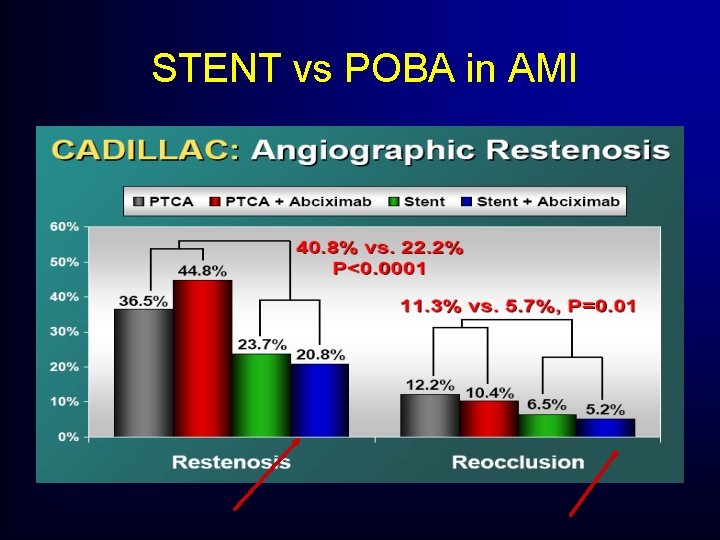 STENT vs POBA in AMI STENT vs POBA in AMI