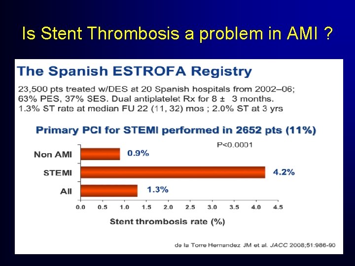 Is Stent Thrombosis a problem in AMI ? Is Stent Thrombosis a problem in AMI ?