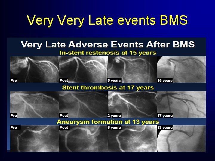Very Late events BMS Very Late events BMS