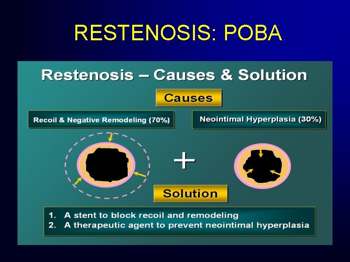RESTENOSIS: POBA RESTENOSIS: POBA