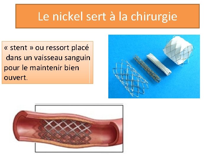 Le nickel sert à la chirurgie « stent » ou ressort placé dans un