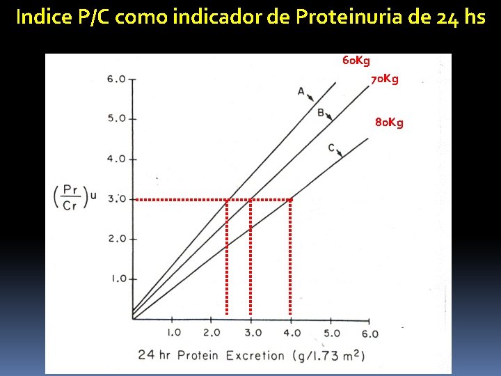 Indice P/C como indicador de Proteinuria de 24 hs 60 Kg 70 Kg 80