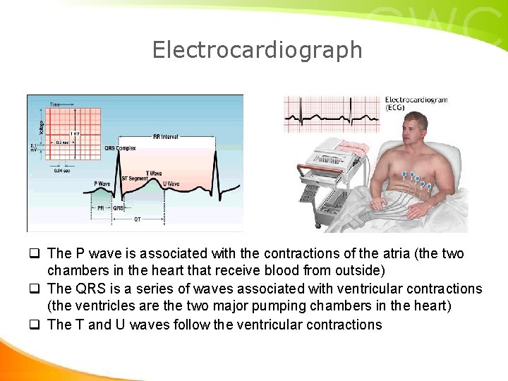 Electrocardiograph q The P wave is associated with the contractions of the atria (the Electrocardiograph q The P wave is associated with the contractions of the atria (the