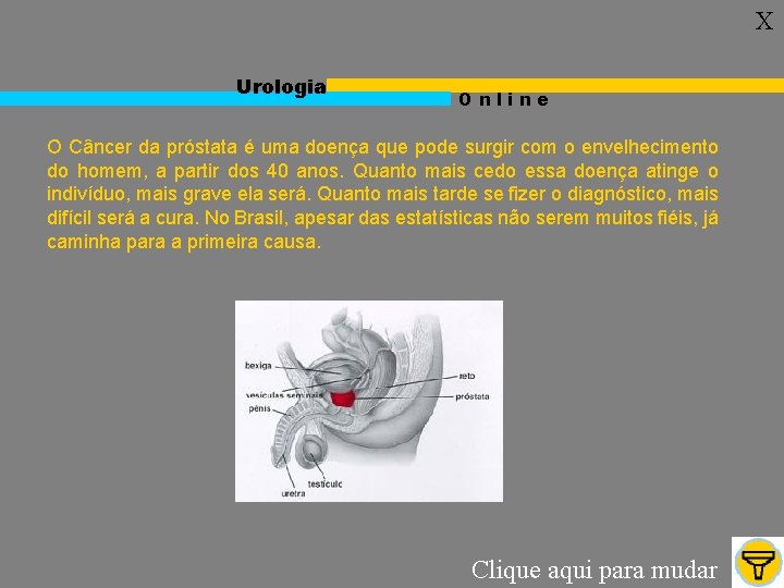 X Urologia Online O Câncer da próstata é uma doença que pode surgir com