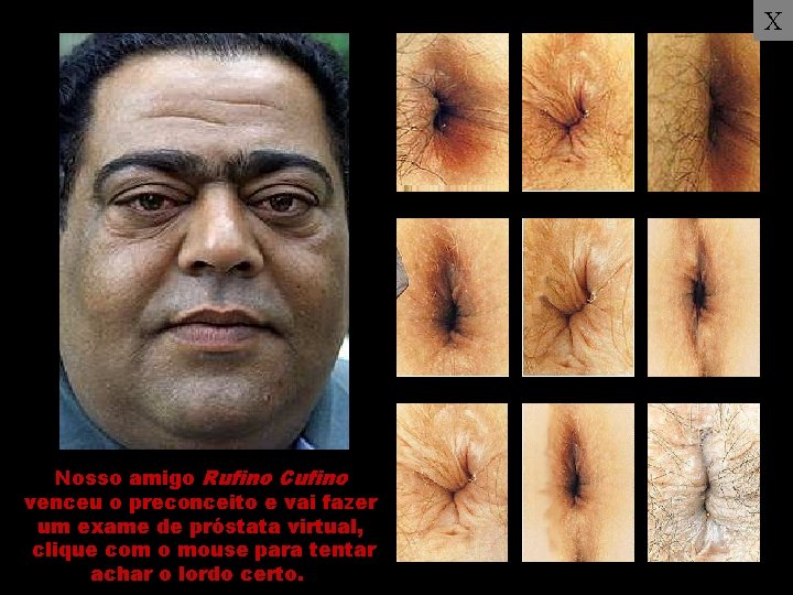 X Nosso amigo Rufino Cufino venceu o preconceito e vai fazer um exame de