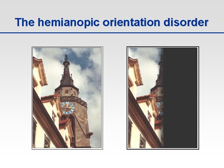The hemianopic orientation disorder 