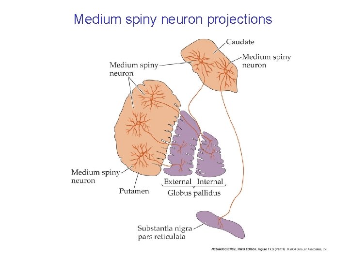 Medium spiny neuron projections 