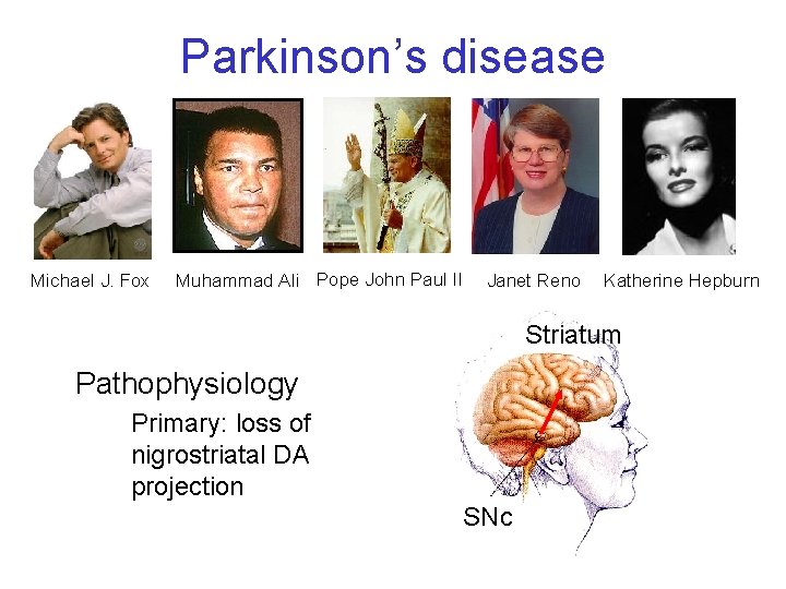 Parkinson’s disease Michael J. Fox Muhammad Ali Pope John Paul II Janet Reno Katherine