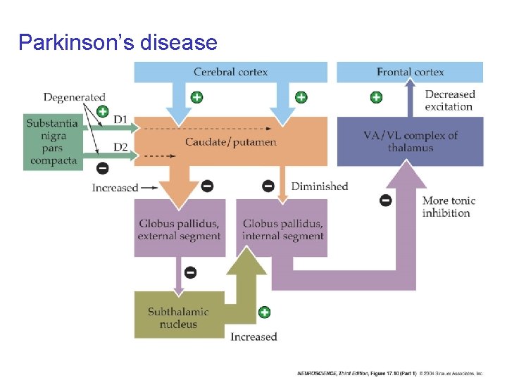 Parkinson’s disease 