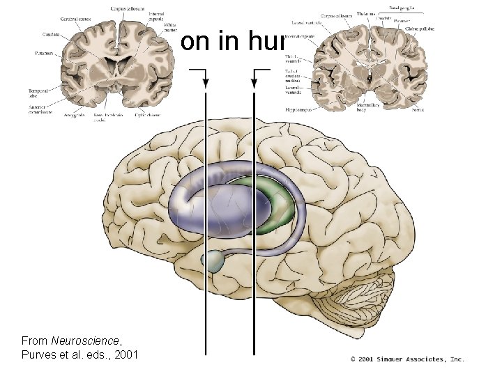 Location in human brain From Neuroscience, Purves et al. eds. , 2001 