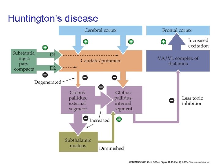 Huntington’s disease 