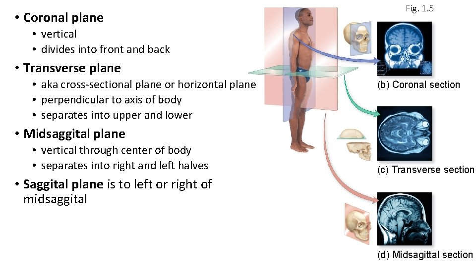  • Coronal plane Fig. 1. 5 • vertical • divides into front and