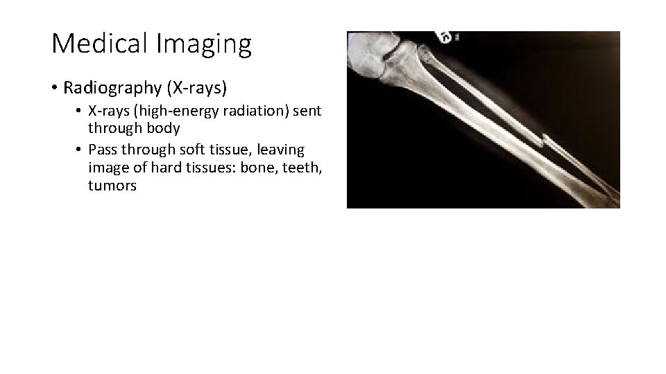 Medical Imaging • Radiography (X-rays) • X-rays (high-energy radiation) sent through body • Pass
