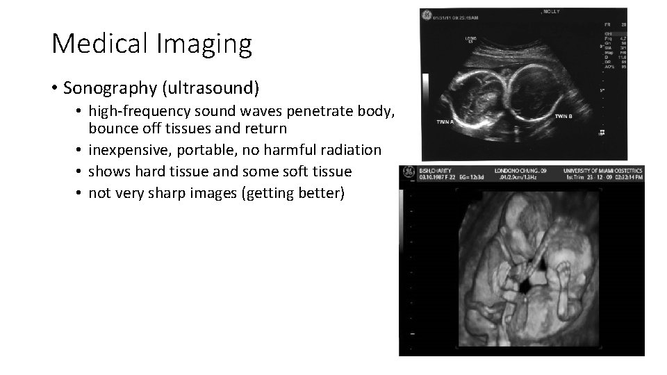 Medical Imaging • Sonography (ultrasound) • high-frequency sound waves penetrate body, bounce off tissues