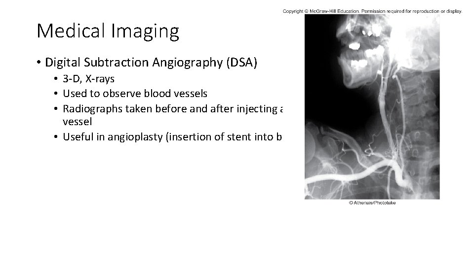 Medical Imaging • Digital Subtraction Angiography (DSA) • 3 -D, X-rays • Used to
