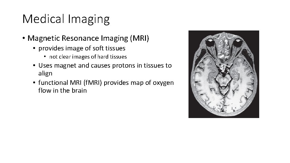 Medical Imaging • Magnetic Resonance Imaging (MRI) • provides image of soft tissues •