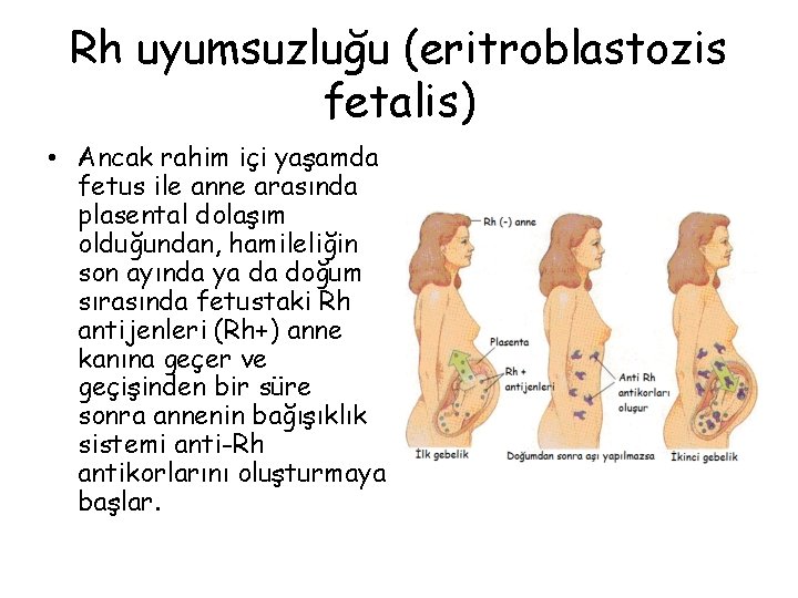 Rh uyumsuzluğu (eritroblastozis fetalis) • Ancak rahim içi yaşamda fetus ile anne arasında plasental