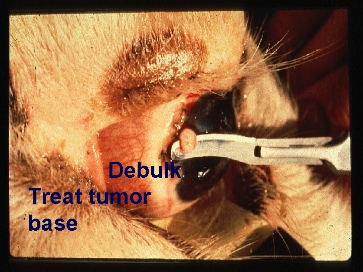 Debulk Treat tumor base 