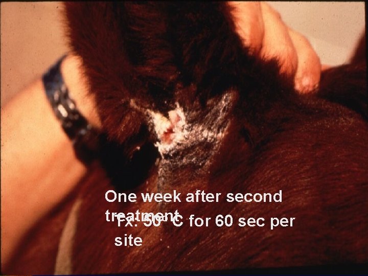 One week after second treatment Tx: 50 o C for 60 sec per site