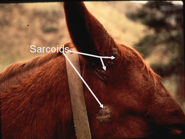 Sarcoids 