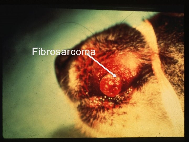 Fibrosarcoma 