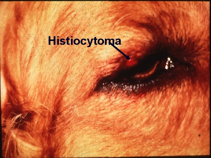 Histiocytoma 