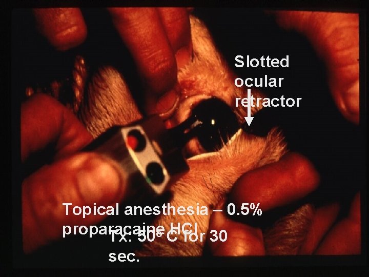 Slotted ocular retractor Topical anesthesia – 0. 5% proparacaine HCl Tx: 50 o C