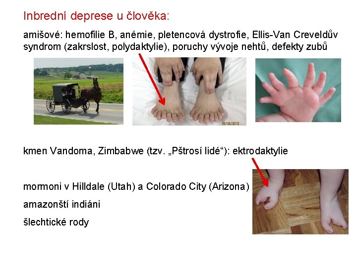 Inbrední deprese u člověka: amišové: hemofilie B, anémie, pletencová dystrofie, Ellis-Van Creveldův syndrom (zakrslost, Inbrední deprese u člověka: amišové: hemofilie B, anémie, pletencová dystrofie, Ellis-Van Creveldův syndrom (zakrslost,