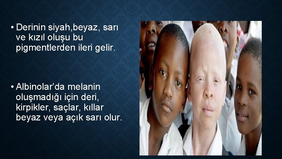 • Derinin siyah, beyaz, sarı ve kızıl oluşu bu pigmentlerden ileri gelir. • • Derinin siyah, beyaz, sarı ve kızıl oluşu bu pigmentlerden ileri gelir. •