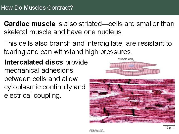 How Do Muscles Contract? Cardiac muscle is also striated—cells are smaller than skeletal muscle