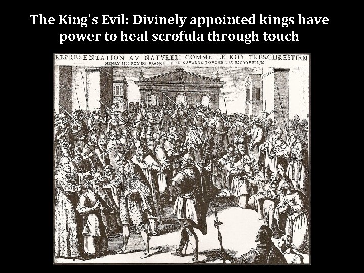 The King’s Evil: Divinely appointed kings have power to heal scrofula through touch 