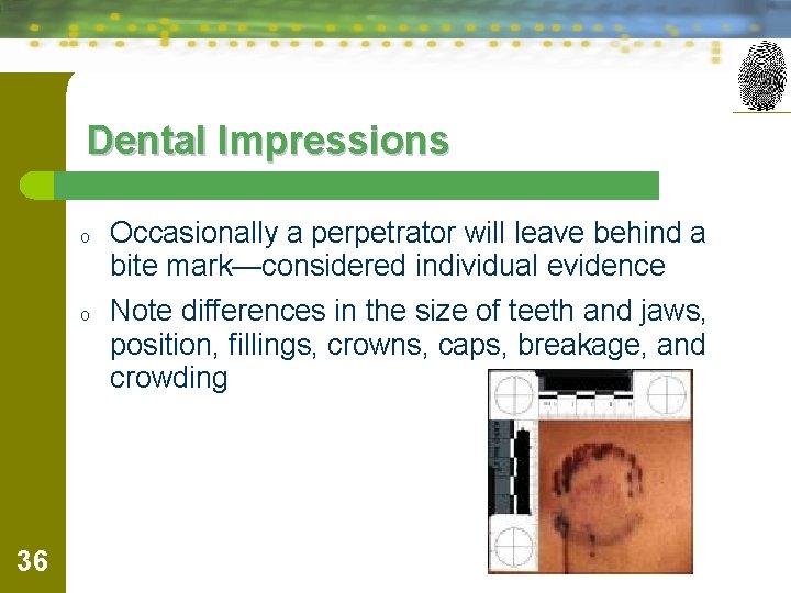 Dental Impressions o o 36 Occasionally a perpetrator will leave behind a bite mark—considered