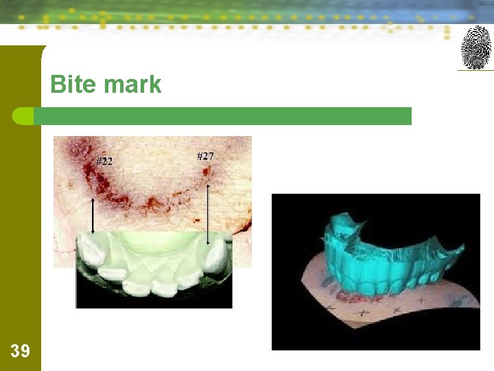 Bite mark 39 