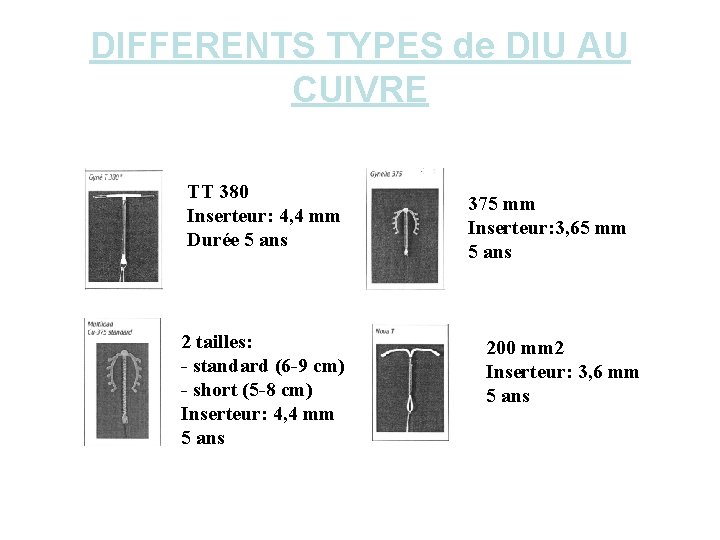 DIFFERENTS TYPES de DIU AU CUIVRE TT 380 Inserteur: 4, 4 mm Durée 5