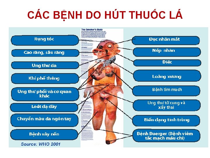 CÁC BỆNH DO HÚT THUỐC LÁ 