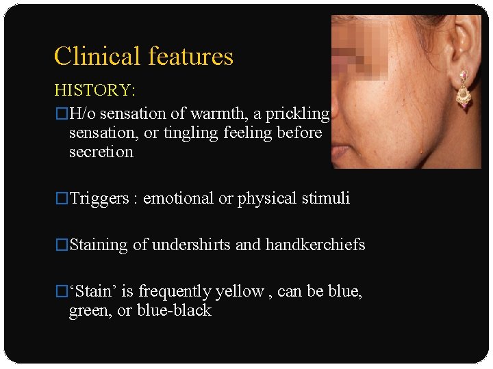 Clinical features HISTORY: �H/o sensation of warmth, a prickling sensation, or tingling feeling before