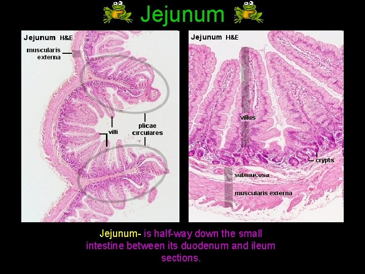 Jejunum- is half-way down the small intestine between its duodenum and ileum sections. 