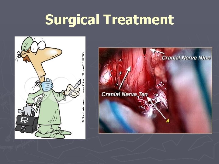 Surgical Treatment 